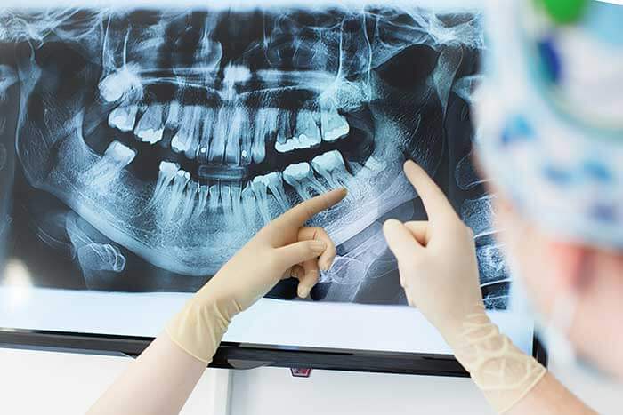 Equipamento de diagnóstico dental moderno para detecção de problemas ocultos.