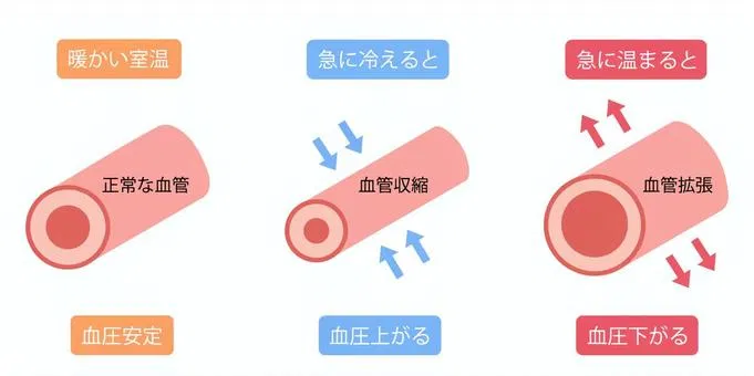 血管拡張のイラスト