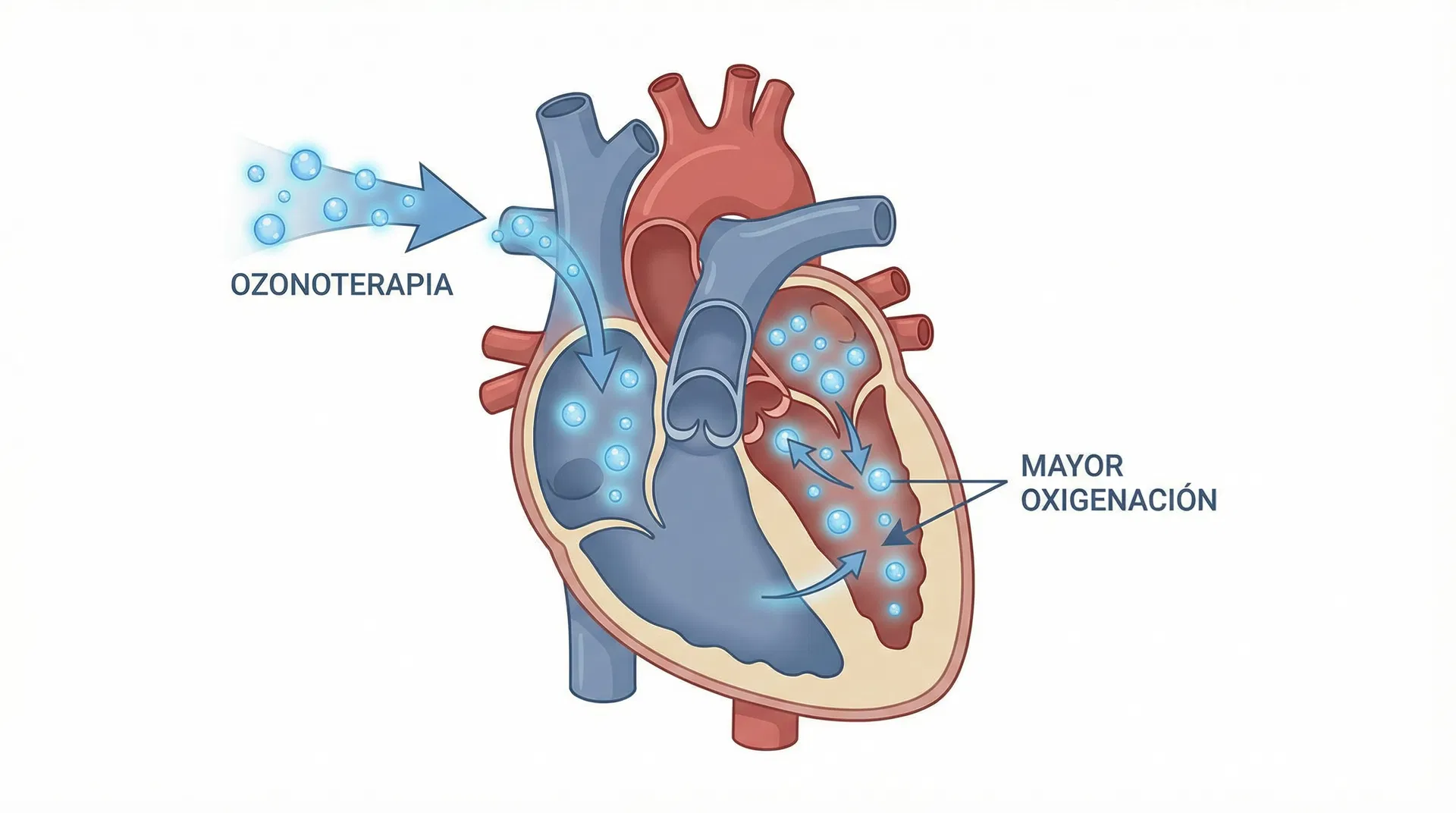 Mejora de la microcirculación con ozono