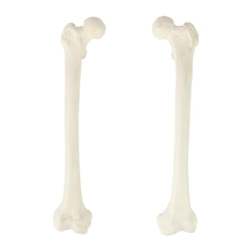 Femur bone - bones of the lower limbs