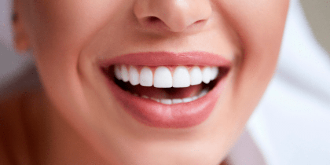 Sorriso perfeito e natural