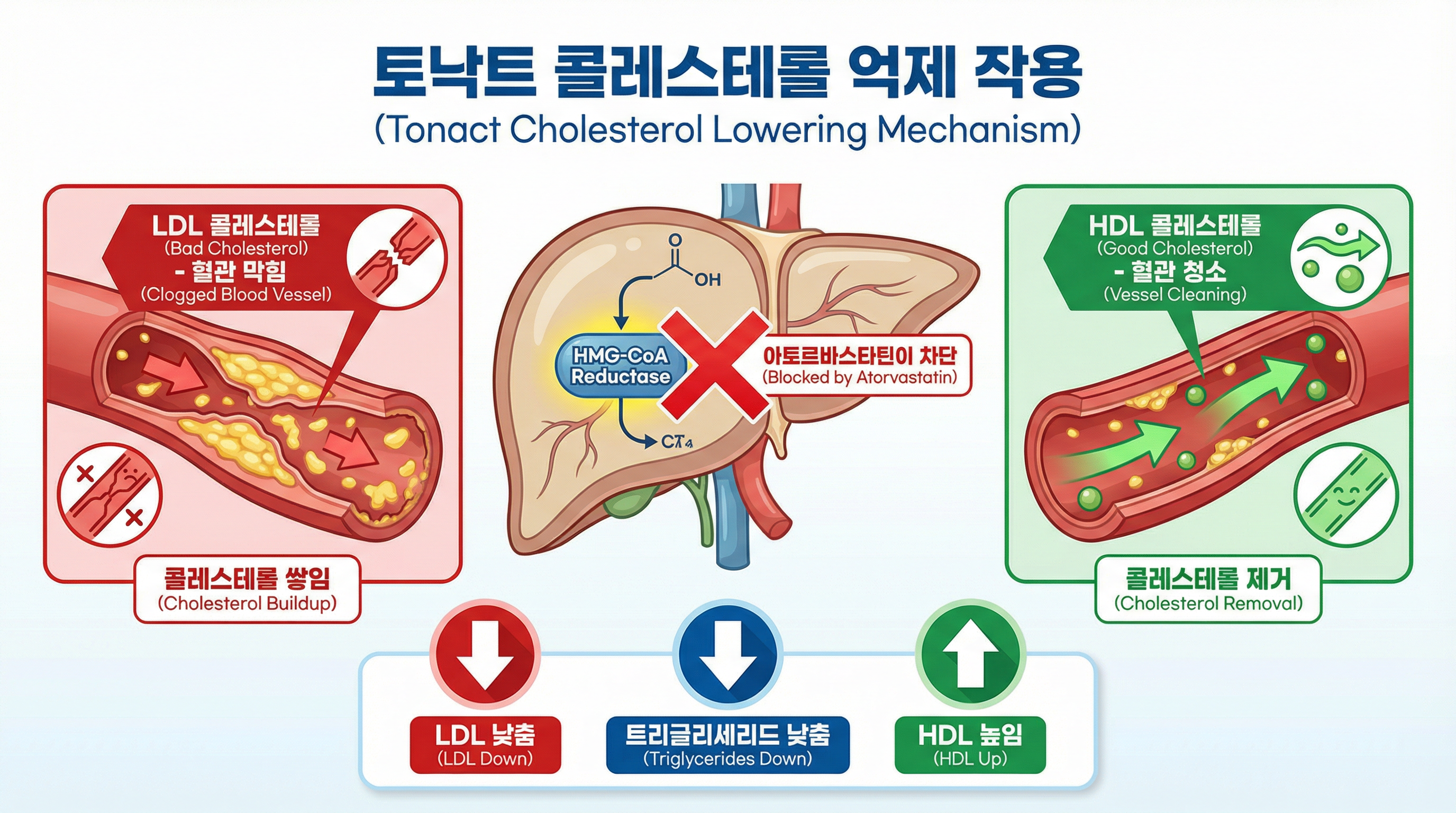 아토르바스타틴의 간 콜레스테롤 합성 억제 메커니즘을 보여주는 인포그래픽