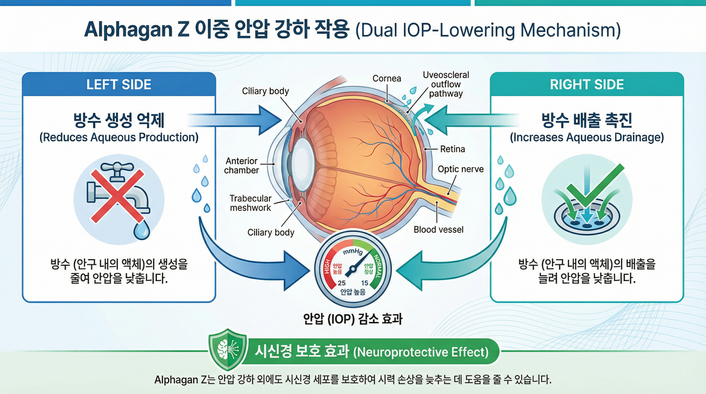 알파간z(alphagan z) 소리 없는 시력 도둑 '녹내장' 방어막 3 방수 생성을 줄이고 배출을 늘리는 알파간z의 이중 작용 기전 인포그래픽