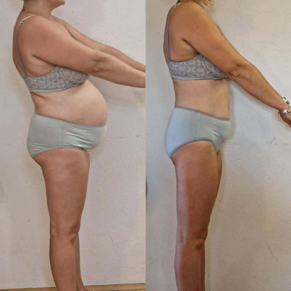 Transformacija klijentice 5