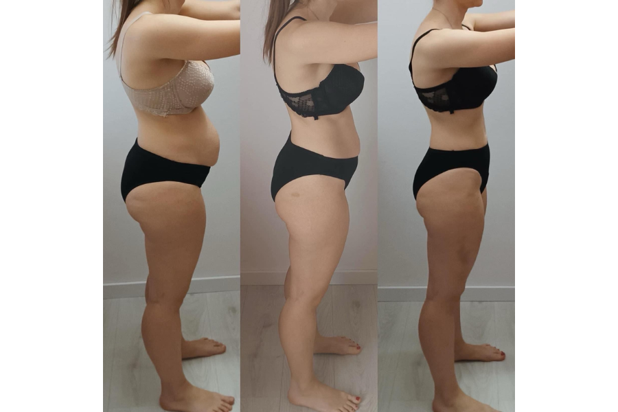 Andreina transformacija kroz 3 faze