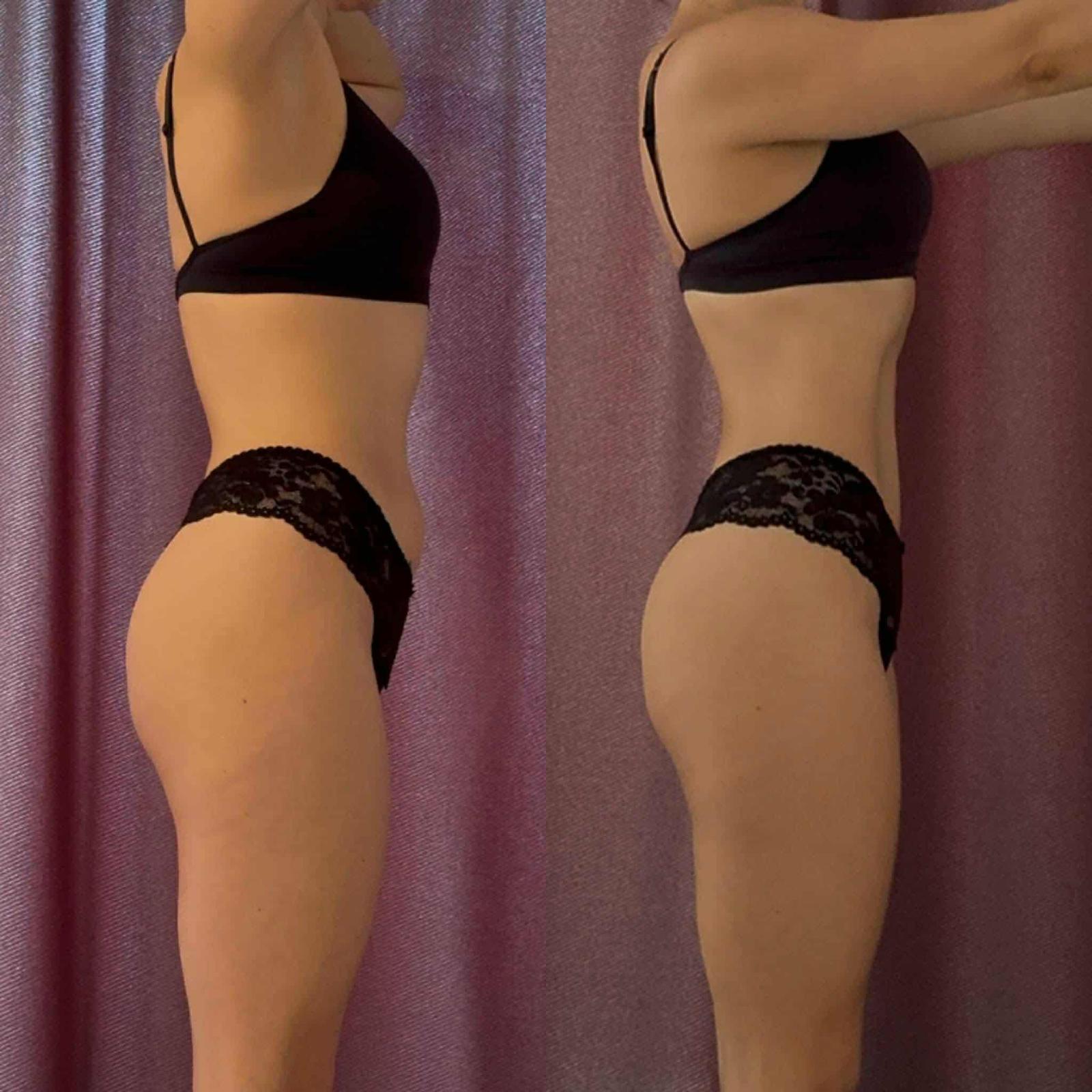 Transformacija klijentice 12