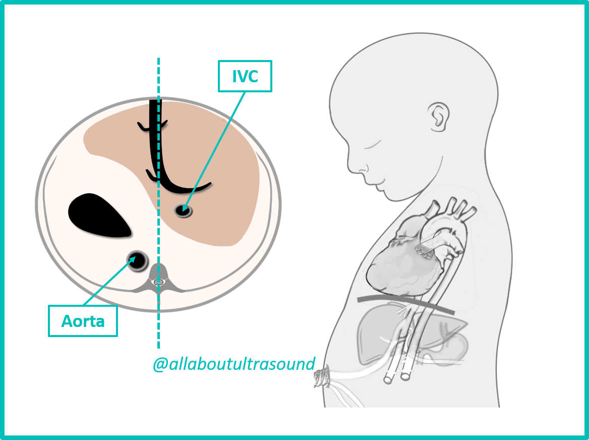 Abdominal Situs View diagram